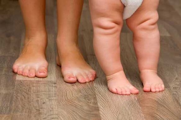 Deformación de valgo en niños